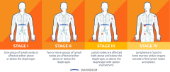 The Four Stages